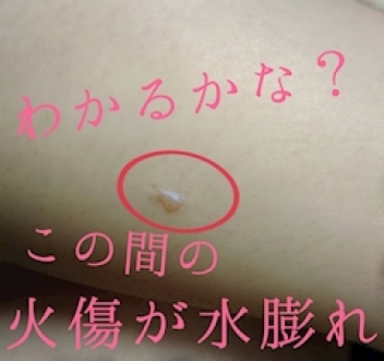 ブログイメージ