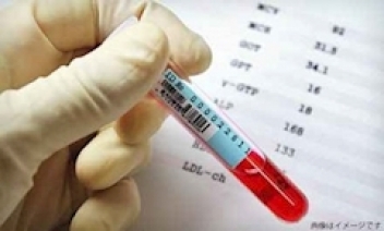 ブログイメージ